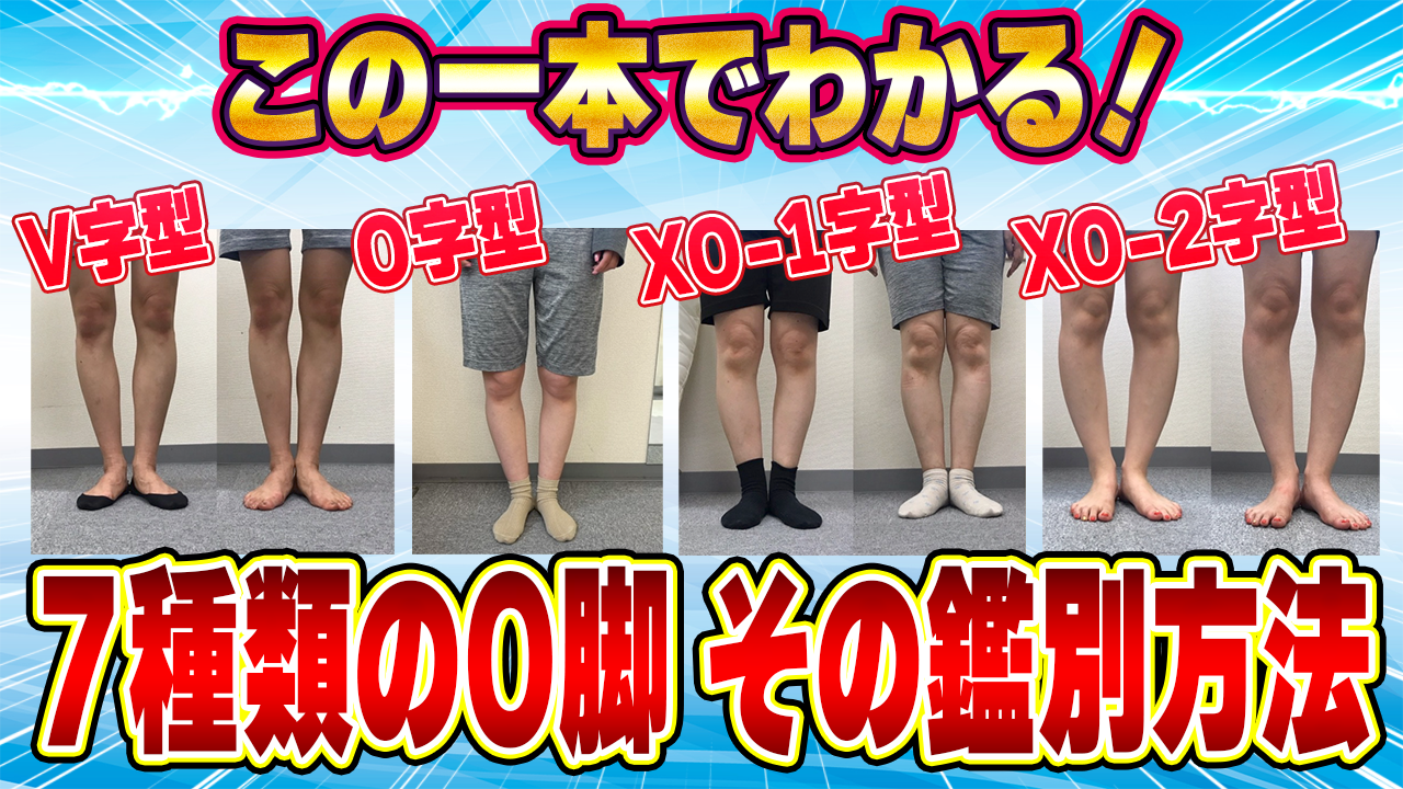 【治療家向け】『完全版』O脚の種類と原因から鑑別方法までを完全解説 | 姿勢・動作分析研究所